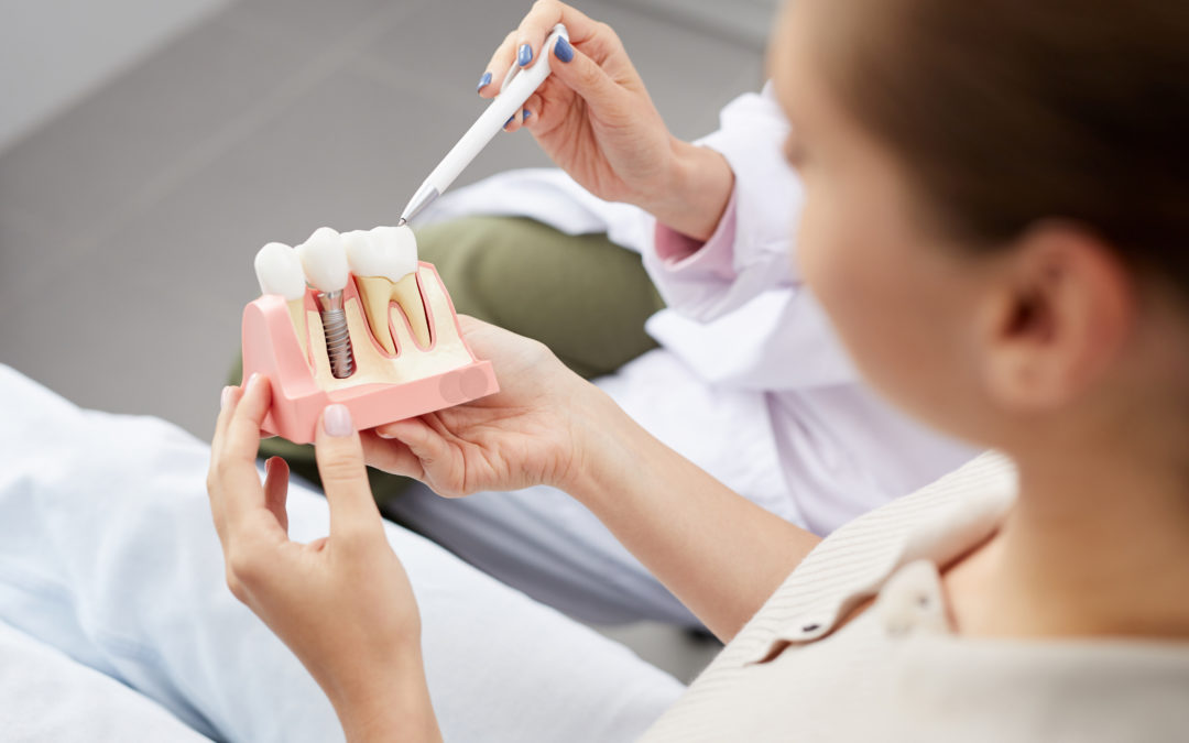 Am I A Good Candidate For Dental Implants? Understanding What Dentists Look For