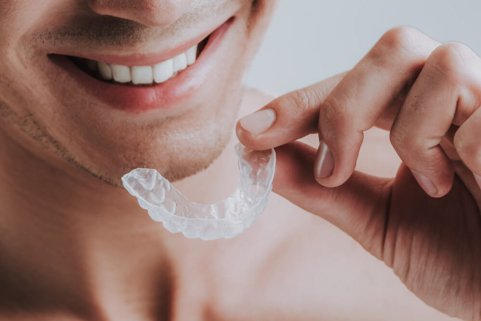 Can You Wear a Mouthguard with Invisalign? McCue Dental Health