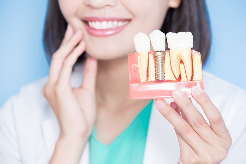 What To Expect During The Dental Implant Placement Process?